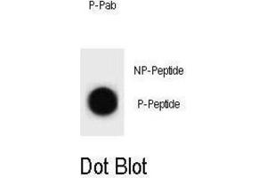 Dot Blot (DB) image for anti-Cyclin B2 (CCNB2) (pThr359) antibody (ABIN3002075) (Cyclin B2 Antikörper  (pThr359))