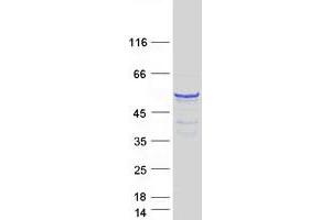 Validation with Western Blot (CPEB1 Protein (Transcript Variant 4) (Myc-DYKDDDDK Tag))