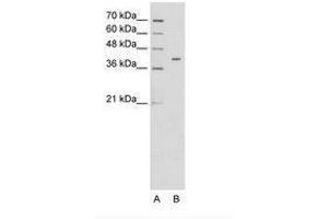 Image no. 1 for anti-Pregnancy Specific beta-1-Glycoprotein 6 (PSG6) (AA 51-100) antibody (ABIN6736625) (PSG6 Antikörper  (AA 51-100))