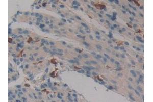 Immunohistochemistry (IHC) image for anti-Coagulation Factor XIII, A1 Polypeptide (F13A1) (AA 372-616) antibody (ABIN7442897)