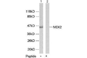 Image no. 1 for anti-Mitogen-Activated Protein Kinase Kinase 2 (MAP2K2) (Thr394) antibody (ABIN197106) (MEK2 Antikörper  (Thr394))