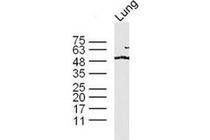Lane 1: mouse lung lysates probed with 	TAZ Polyclonal Antibody, Unconjugated  at 1:300 overnight at 4˚C. (TAZ Antikörper  (AA 1-100))