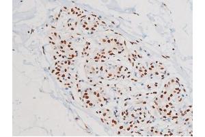 ABIN6267527 at 1/200 staining Human heart tissue sections by IHC-P.