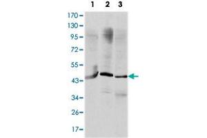 Western blot analysis using OTX2 monoclonal antobody, clone 1H12G8B2  against HepG2 (1), Jurkat (2), and NTERA-2 (3) cell lysate. (OTX2 Antikörper)