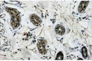 Immunohistochemistry of paraffin-embedded Human colon tissue using beta Tubulin Monoclonal Antibody at dilution of 1:200. (TUBB Antikörper)