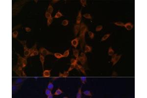 Immunofluorescence analysis of NIH/3T3 cells using PPP3R1 Polyclonal Antibody at dilution of 1:100. (PPP3R1 Antikörper)