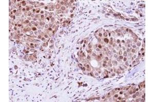 Image no. 1 for anti-RAD23 Homolog B (RAD23B) (AA 164-409) antibody (ABIN1500578) (RAD23B Antikörper  (AA 164-409))