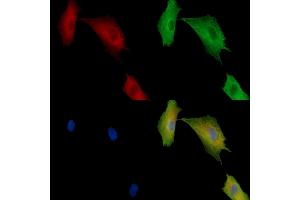 ABIN7096899 and ABIN7100965 staining  cells by IF/ICC. (MBOAT1 Antikörper)