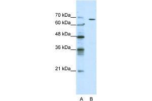 WB Suggested Anti-GABRQ Antibody Titration:  0. (GABRQ Antikörper  (N-Term))