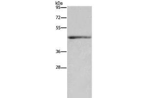 Western Blot analysis of Mouse heart tissue using IL5RA Polyclonal Antibody at dilution of 1:650 (IL5RA Antikörper)