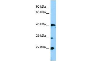WB Suggested Anti-Gm13152 Antibody Titration: 1. (Zfp982 Antikörper  (N-Term))