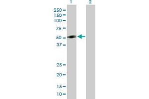 Western Blot analysis of CRLF1 expression in transfected 293T cell line by CRLF1 MaxPab polyclonal antibody. (CRLF1 Antikörper  (AA 1-422))