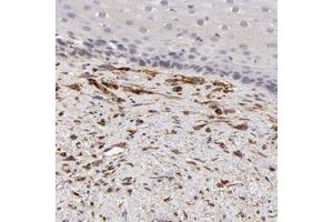 Immunohistochemical staining of human esophagus with SPARC polyclonal antibody  shows distinct positivity in fibroblasts. (SPARC Antikörper)