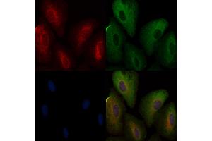 ABIN6257946 and ABIN6274871 staining  cells by IF/ICC.