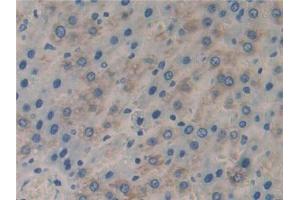 IHC-P analysis of Rat Liver Tissue, with DAB staining. (FLIP Antikörper  (AA 43-281))