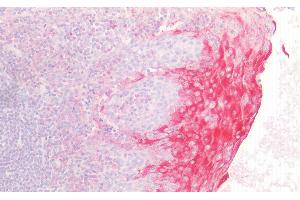 Detection of DGKa in Human Tonsil Tissue using Polyclonal Antibody to Diacylglycerol Kinase Alpha (DGKa) (DGKA Antikörper  (AA 305-531))