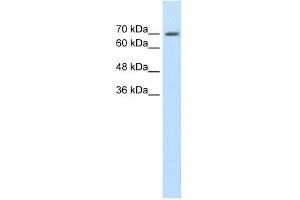 WB Suggested Anti-EPS8L1 Antibody Titration:  1. (EPS8-Like 1 Antikörper  (N-Term))