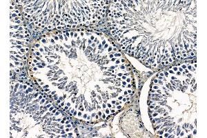 ABIN7095319 and ABIN7099376 at 1/100 staining rat testis tissue by IHC-P. (P4HA3 Antikörper)