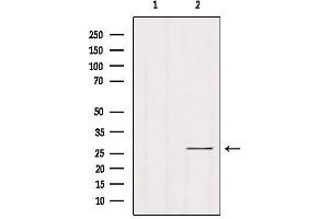 Western blot analysis of extracts from Hela, using RAB33B Antibody. (RAB33B Antikörper  (Internal Region))