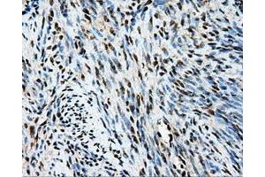 Immunohistochemical staining of paraffin-embedded endometrium tissue using anti-TIPRLmouse monoclonal antibody.