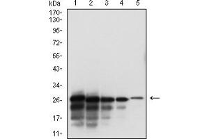 Western blot analysis using SARS-CoV-2-NP3 mAb against human SARS-CoV-2-N (AA: 240-419) recombinant protein. (SARS-CoV-2-NP3 (AA 240-419) Antikörper)