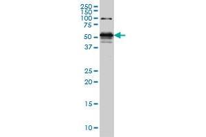 STK38 monoclonal antibody (M05), clone 6G11 Western Blot analysis of STK38 expression in Hela S3 NE . (STK38 Antikörper  (AA 365-465))