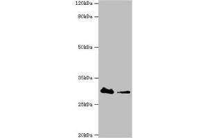 Western blot All lanes: Carbonyl reductase [NADPH] 3 antibody at 10 μg/mL Lane 1: Hela whole cell lysate Lane 2: K562 whole cell lysate Secondary Goat polyclonal to rabbit IgG at 1/10000 dilution Predicted band size: 31 kDa Observed band size: 31 kDa (CBR3 Antikörper  (AA 118-277))