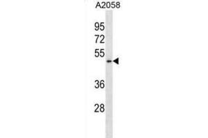 Western Blotting (WB) image for anti-Bifunctional Apoptosis Regulator (BFAR) antibody (ABIN2998941) (BFAR Antikörper)