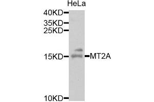 Western blot analysis of extracts of HeLa cells, using MT2A antibody. (MT2A Antikörper)