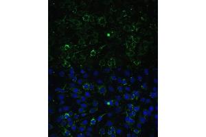 Immunofluorescence analysis of C6 cells using  antibody (ABIN6131426, ABIN6136765, ABIN6136766 and ABIN6223405) at dilution of 1:100.