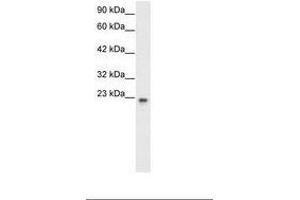 Image no. 2 for anti-General Transcription Factor IIF, Polypeptide 2, 30kDa (GTF2F2) (AA 132-181) antibody (ABIN6735771) (GTF2F2 Antikörper  (AA 132-181))