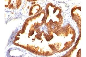 ABIN6383865 to KRT18 was successfully used to stain (malignant) epithelial cells in human prostate carcinoma sections.