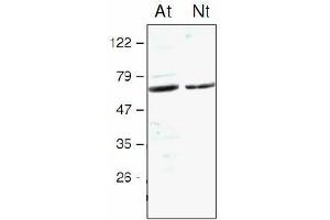 Western blot analysis of Arabidopsis thaliana (At) and Nicotiana tabacum (Nt) chloroplast proteins with anti-STN7 kinase (STN7 Kinase Antikörper)