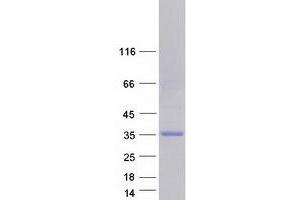 Validation with Western Blot (MBNL3 Protein (Transcript Variant 3) (Myc-DYKDDDDK Tag))
