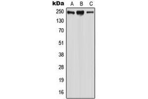 Western blot analysis of WNK2 expression in HeLa (A), MCF7 (B), SP2/0 (C) whole cell lysates.