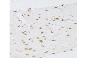 Immunohistochemistry of paraffin-embedded Human stomach using CSRP3 Polyclonal Antibody at dilution of 1:100 (40x lens). (CSRP3 Antikörper)
