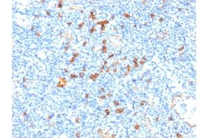 Immunohistochemistry (IHC) image for anti-Interleukin 3 Receptor, alpha (IL3RA) (AA 26-171) antibody (ABIN6939783)
