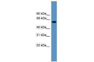 Western Blot showing RAP1GDS1 antibody used at a concentration of 1.