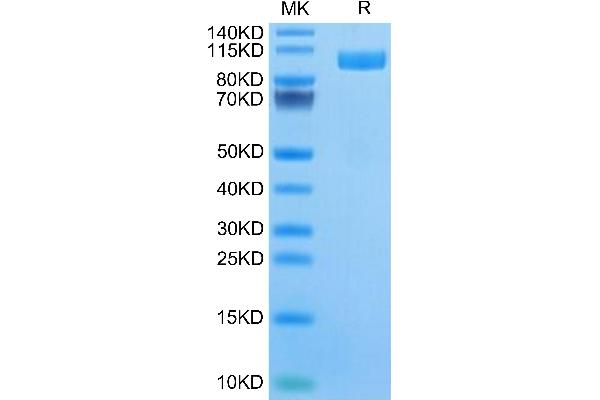 CD166 Protein (AA 28-526) (Fc Tag)