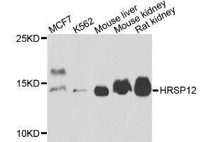 Western blot analysis of extracts of various cell lines, using HRSP12 antibody (ABIN5972464) at 1/1000 dilution. (HRSP12 Antikörper)