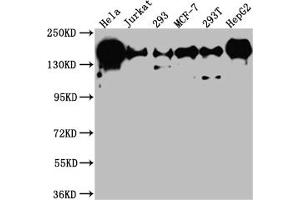 Western Blot Positive WB detected in: Hela whole cell lysate, Jurkat whole cell lysate, 293 whole cell lysate, MCF-7 whole cell lysate, 293T whole cell lysate, HepG2 whole cell lysate All lanes: PELP1 antibody at 1:1000 Secondary Goat polyclonal to rabbit IgG at 1/50000 dilution Predicted band size: 120 kDa Observed band size: 160 kDa (Rekombinanter PELP1 Antikörper)