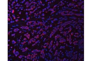 IF analysis of Syntaxin 18/STX18 using anti-Syntaxin 18/STX18 antibody (ABIN7599259). (Syntaxin 18 Antikörper  (AA 1-313))
