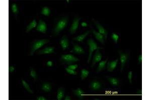 Image no. 2 for anti-Transcription Factor 19 (TCF19) (AA 17-103) antibody (ABIN598965) (TCF19 Antikörper  (AA 17-103))