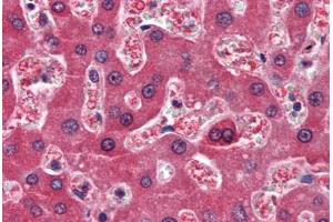 Human Liver (formalin-fixed, paraffin-embedded) stained with RBP4 antibody ABIN364444 at 10 ug/ml followed by biotinylated anti-mouse IgG secondary antibody ABIN481714, alkaline phosphatase-streptavidin and chromogen. (RBP4 Antikörper  (AA 19-201))