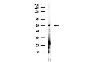 anti-Casein Kinase 1, delta (CSNK1D) (Internal Region) antibody