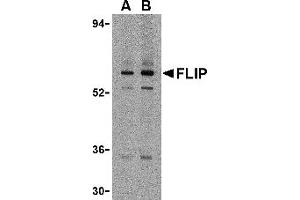 Western Blotting (WB) image for anti-CASP8 and FADD-Like Apoptosis Regulator (CFLAR) (N-Term) antibody (ABIN1031381) (FLIP Antikörper  (N-Term))