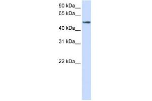 WB Suggested Anti-USP22 Antibody Titration: 0. (USP22 Antikörper  (Middle Region))