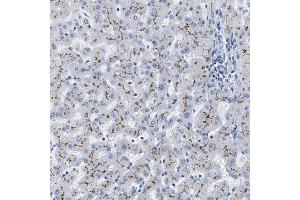 Immunohistochemical staining (Formalin-fixed paraffin-embedded sections) of human liver shows moderate membranous positivity in hepatocytes. (ABCB11 Antikörper  (AA 616-746))