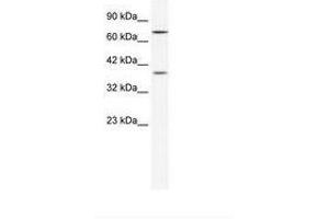 Image no. 1 for anti-Zinc Finger Protein 660 (ZNF660) (C-Term) antibody (ABIN202267) (ZNF660 Antikörper  (C-Term))
