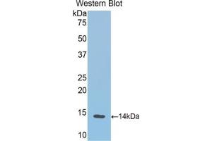 Detection of Recombinant HB, Cattle using Polyclonal Antibody to Hemoglobin (HB) (Hemoglobin Antikörper)